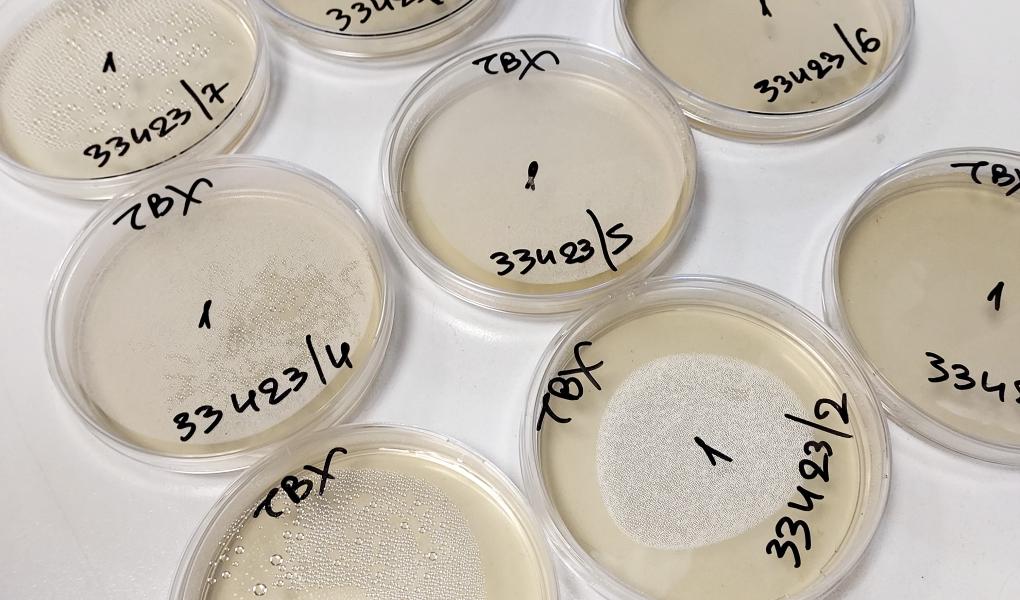 Bacteria cultivation in petri dishes, the cheeses are tested for E.coli and Listeria. Photo: Foodlab